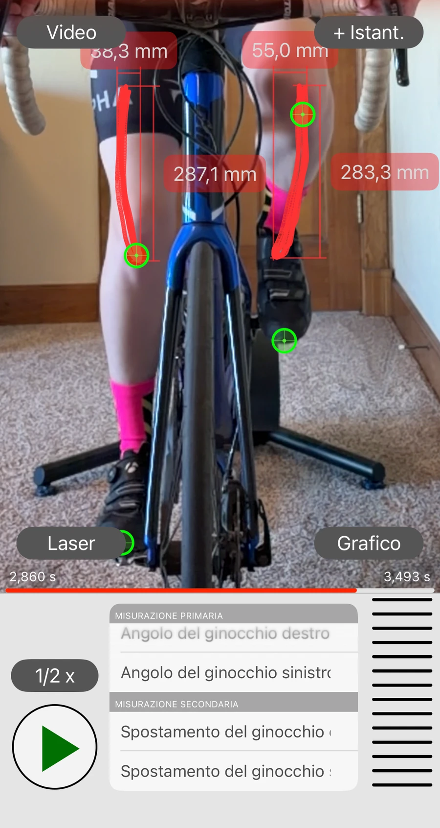 Il tracciato in Bike Fast Fit Elite su una registrazione frontale: il percorso di ciascun ginocchio disegnato in rosso lungo la pedalata, con i valori dello spostamento a fianco e l'elenco delle misurazioni che mostra angolo e spostamento del ginocchio